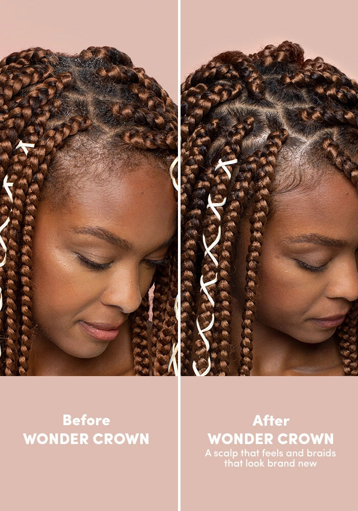 Wonder Crown by MIZANI
